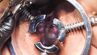 Fisting, medioeval Speculum and Orgasm for Lady Soniac wild milf