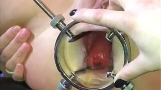 Triple Fist Anal Mistress Action *** Watch Siswet Live On XXXFREECHAT.COM/SISWET19