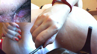 Medical anal endoscope fisting and extreme masturbation